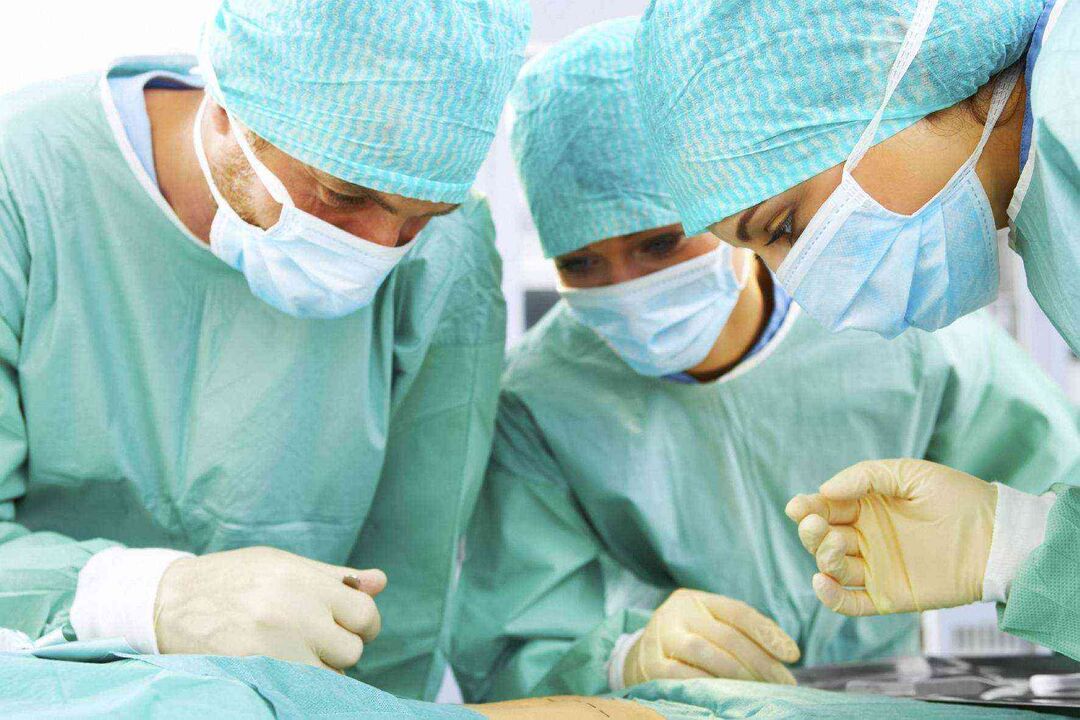 Penis enlargement surgery and its price 3