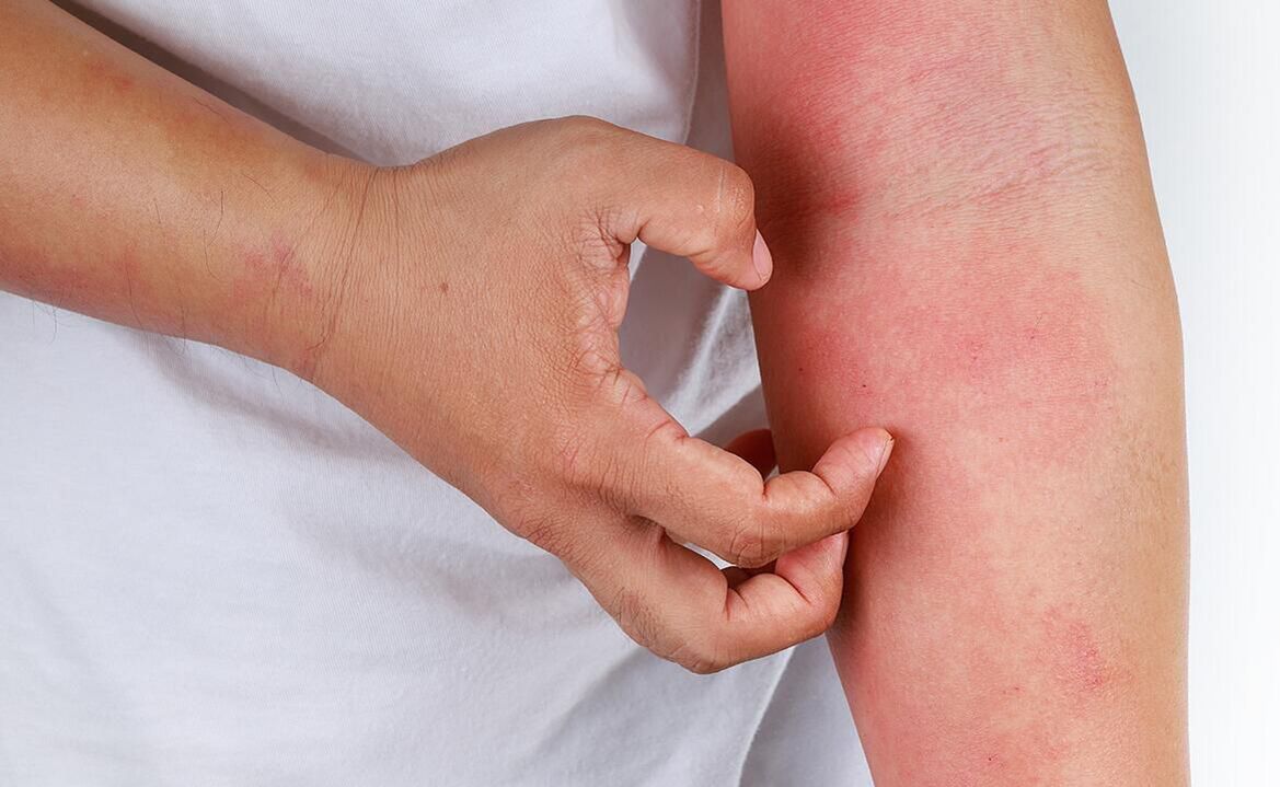 possible side effects of using soda