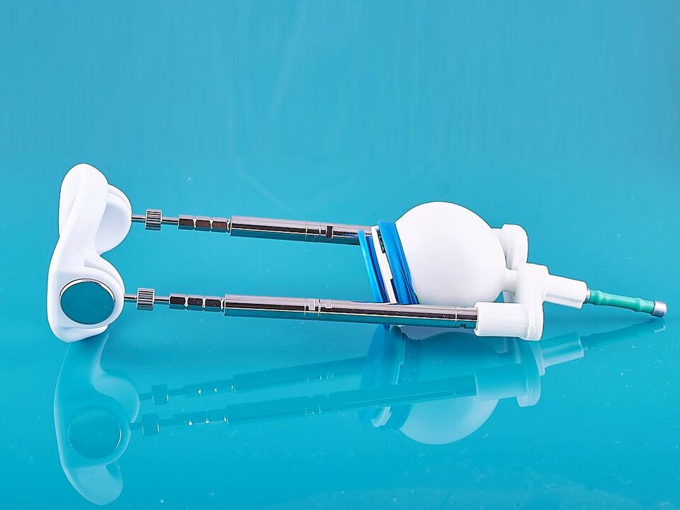 The expander will help improve the outcome of the ligamentotomy