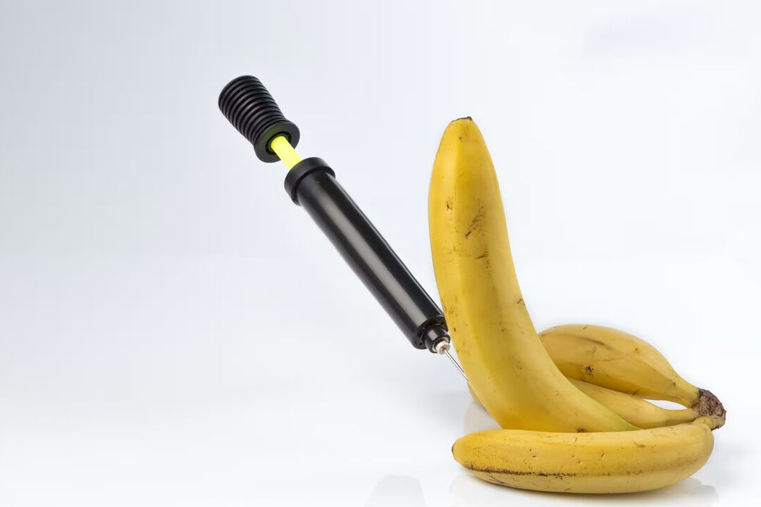 Lipofilling - penis enlargement by injecting fat tissue
