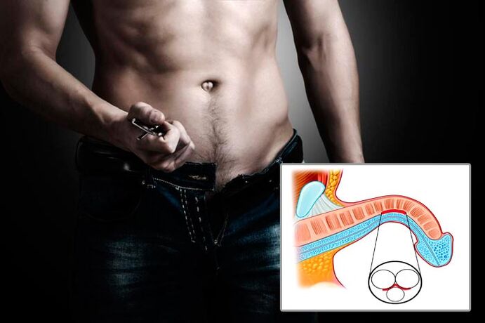 Man opens his fly for penis expansion exercises